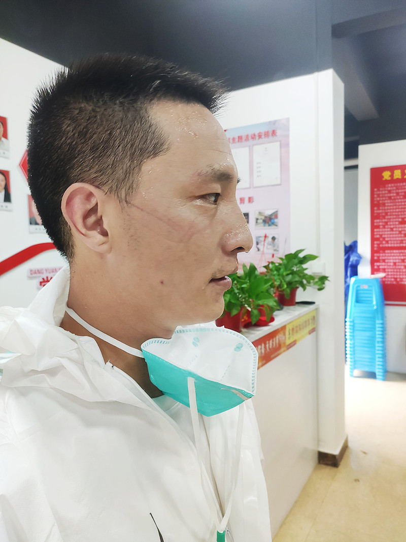 志愿者充滿N95口罩勒痕的臉上滿頭大汗.jpg
